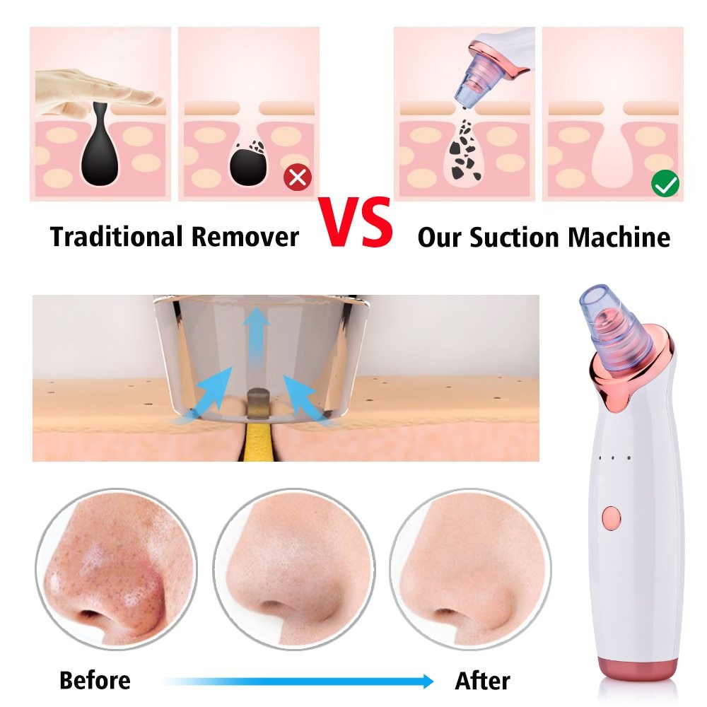 Facial Washing Instrument